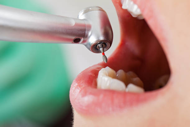 Best Emergency Cosmetic Dentistry (e.g., broken veneers) in River Rouge, MI